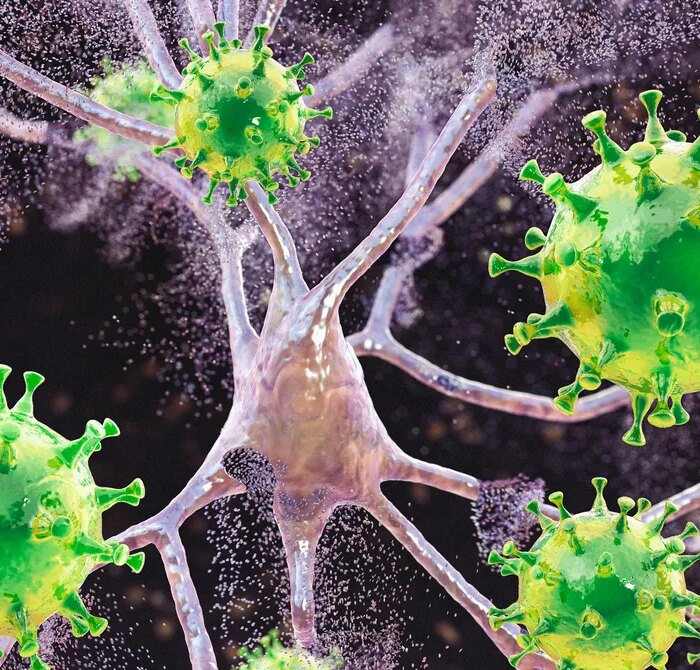 Measles Is Causing Brain Swelling in Children in South Carolina