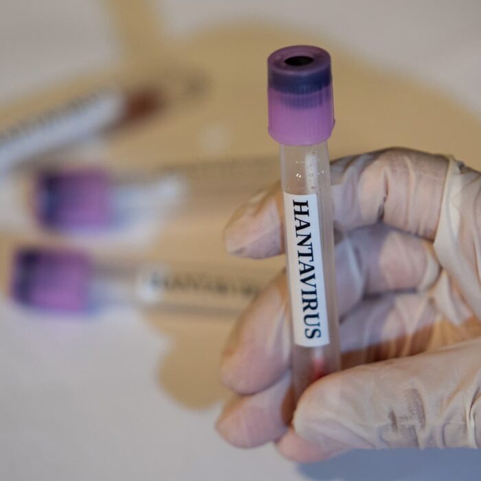 CDC says there are no U.S. hantavirus cases currently, 41 people being monitored