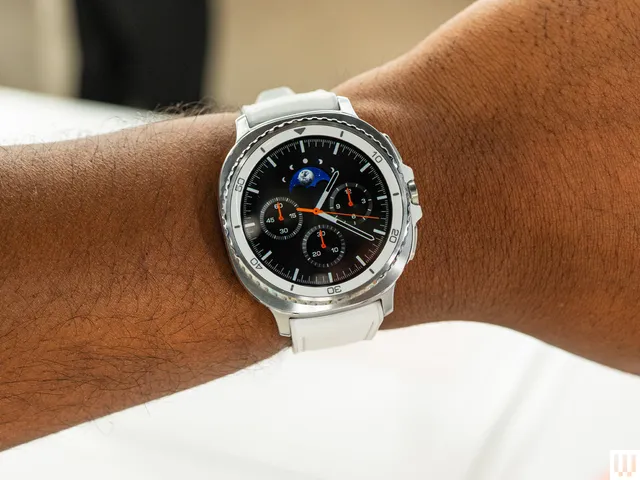 Image may contain: Wristwatch, Arm, Body Part, and Person