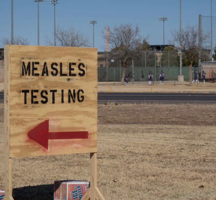 As US measles cases rise, biotech firms start developing new treatments